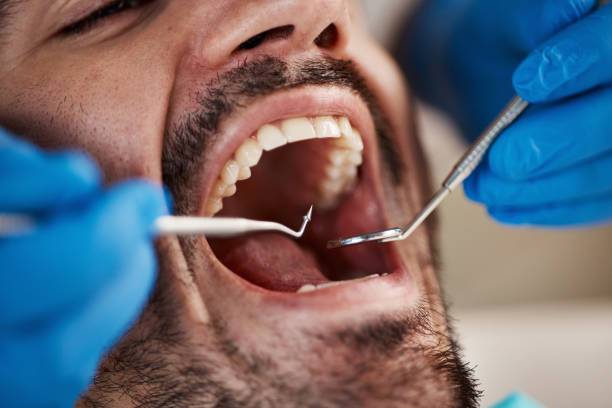 Best Broken Tooth Emergency  in Rice Lake, MN